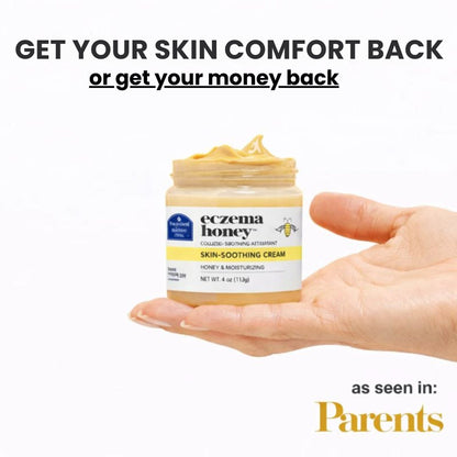 Eczema Honey Relief