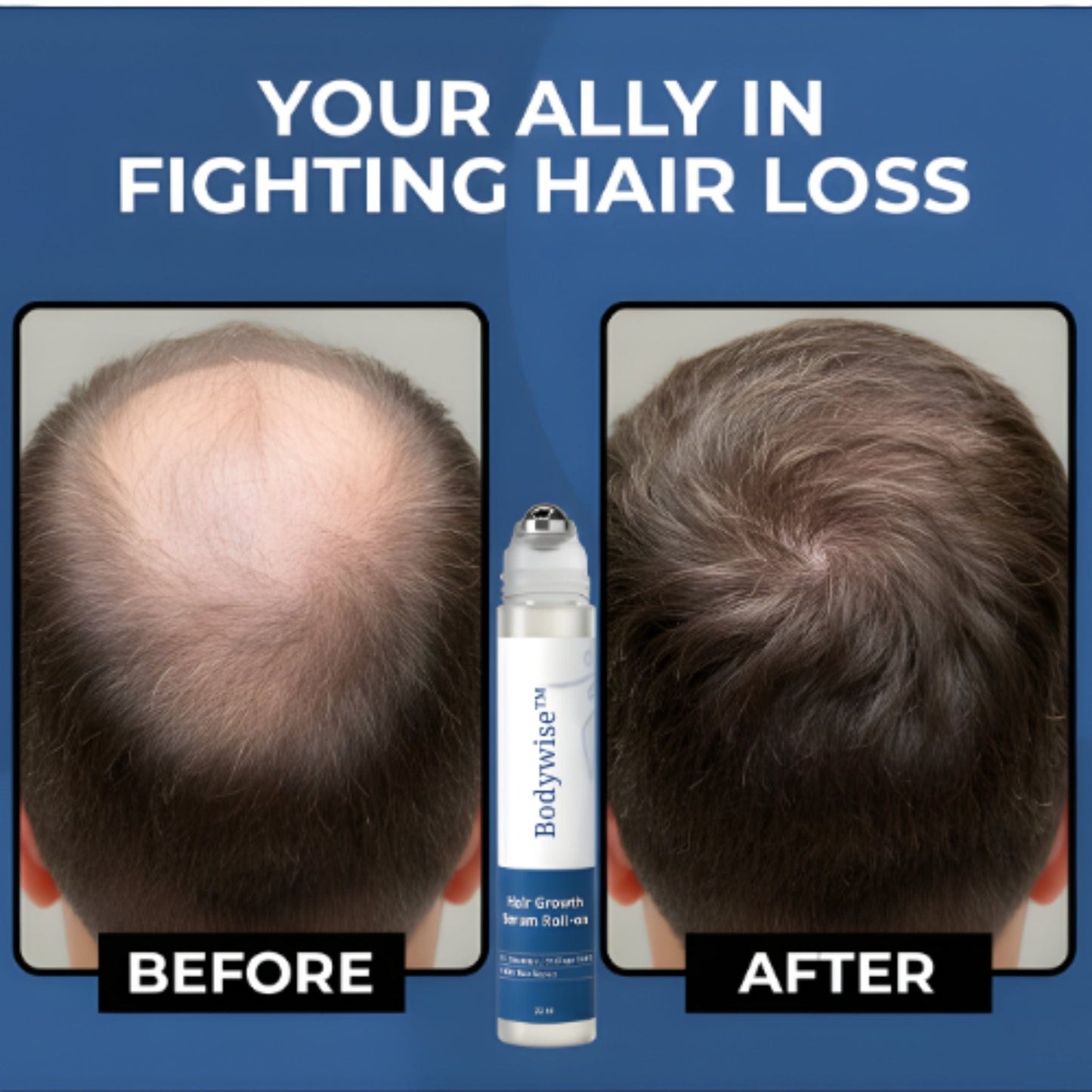 Hair Growth Serum Roll-on Serum