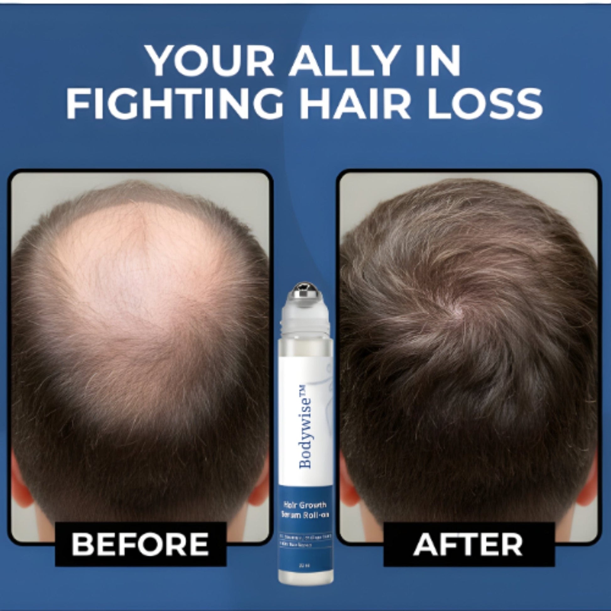 Hair Growth Serum Roll-on Serum